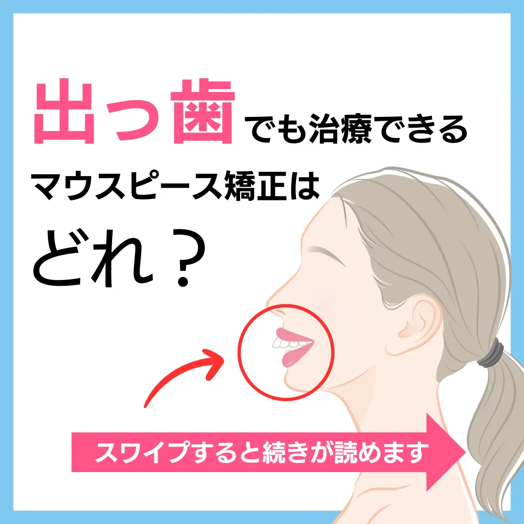 出っ歯
でも治療できる
マウスピース矯正は
どれ？
スワイプすると続きが読めます