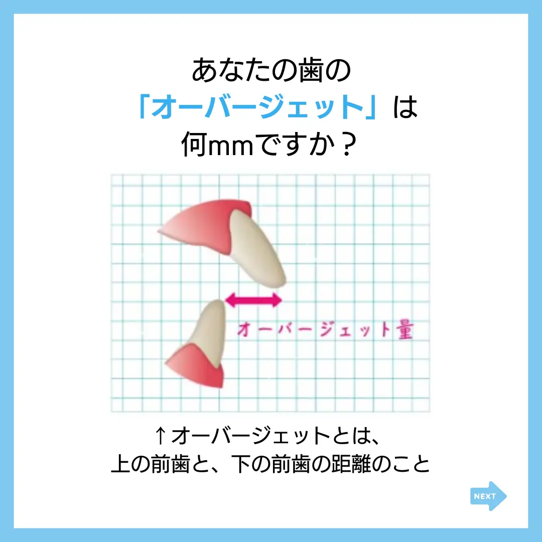 あなたの歯の
「オーバージェット」は
何mmですか？
↑オーバージェットとは、
上の前歯と、下の前歯の距離のこと