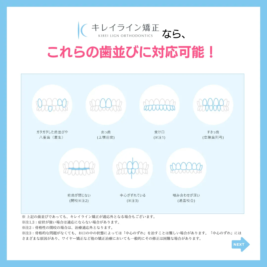 （キレイライン緒正KIREI LIGN ORTHODONTICSなら、
これらの歯並びに対応可能！
カタカタした歯並びや八重歯（生）
出つ歯（上額前笑）
受け口（※注1）
すきっ歯（空隙歯列弓）
前歯が閉じない（開咬 注2）
中心がずれている（※注3）
噛み合わせが深い（過蓋咬合）
※上記の歯並びであっても、キレイライン矯正が適応外となる場合もございます。
※注1.3：症状が強い場合は適応にならない場合があります。
※注2：得格性の開の場合は、治療適応外となります。
※注る：骨格的な問題がなくても、お口の中の状態によっては「中心のずれ」を治すことは難しい場合があります。「中心のずれ」には
さまざまな原因があり、ワイヤー矯正など他の矯正治療においても一般的にその修正は困難な場合があります。